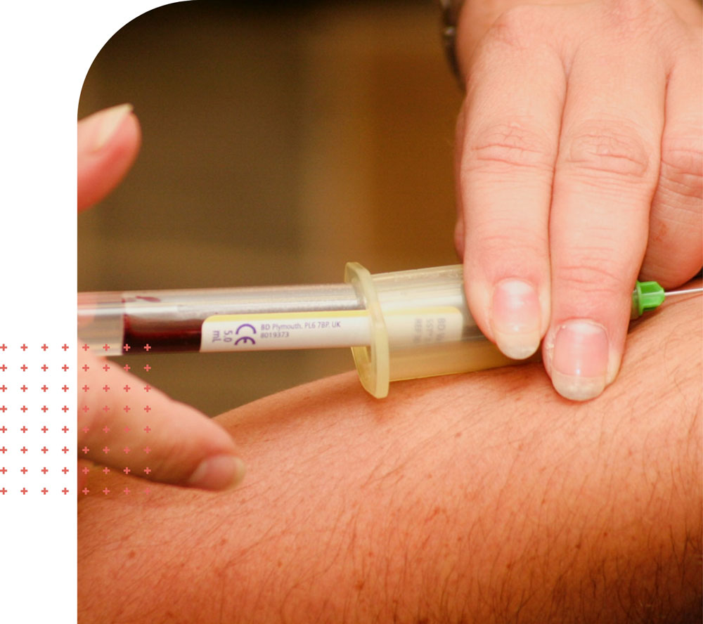 PRP Injections